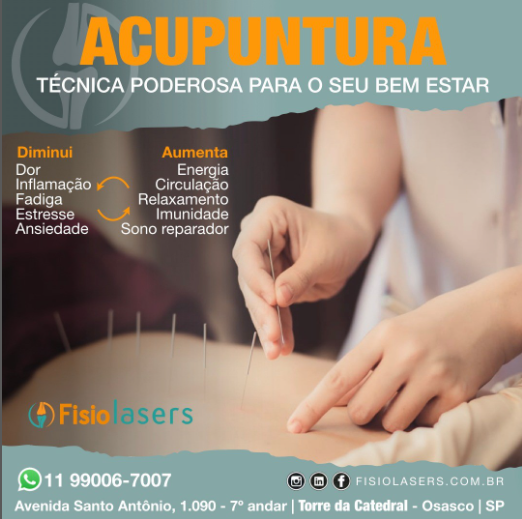 Acupuntura técnica poderosa para o seu bem estar